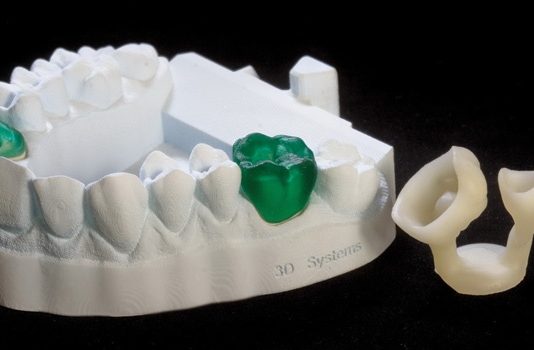 3Д принтеры в стоматологии: полезное новшество