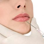 Филлеры на основе гиалуроновой кислоты: безупречная молодость