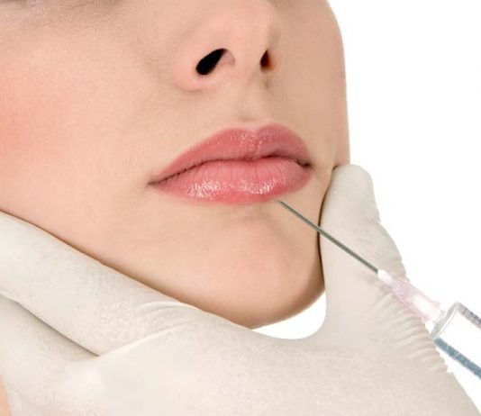 Филлеры на основе гиалуроновой кислоты: безупречная молодость