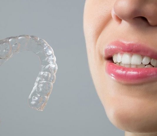 Как правильно ухаживать за элайнерами