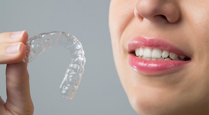 Как правильно ухаживать за элайнерами