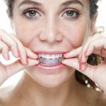 Ортодонтическое лечение с помощью элайнеров Invisalign