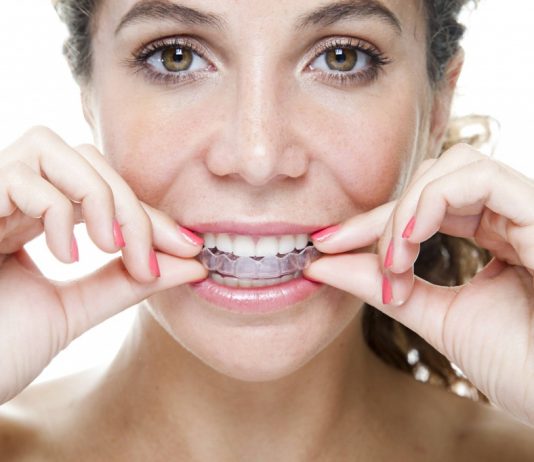 Ортодонтическое лечение с помощью элайнеров Invisalign