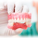 Показания к съемному протезированию в стоматологии