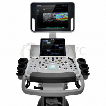 Хороший аппарат УЗИ или выбираем самый лучший