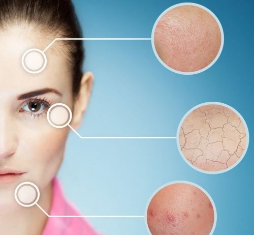 Причины для обращения к дерматологу