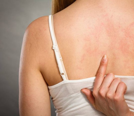 Кожные заболевания: виды, признаки, лечение