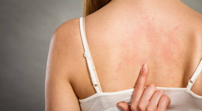 Кожные заболевания: виды, признаки, лечение