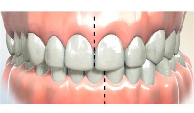 Можно ли исправить прикус у взрослого человека?