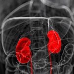 Что такое нефроптоз