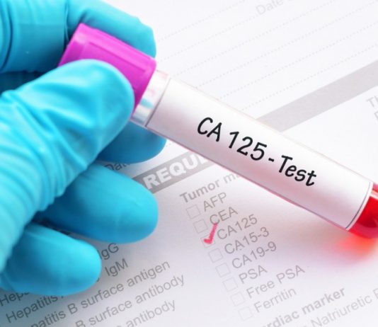 Онкомаркер рака яичника СА-125: как проводится анализ?