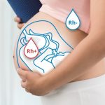 Резус-конфликт при беременности