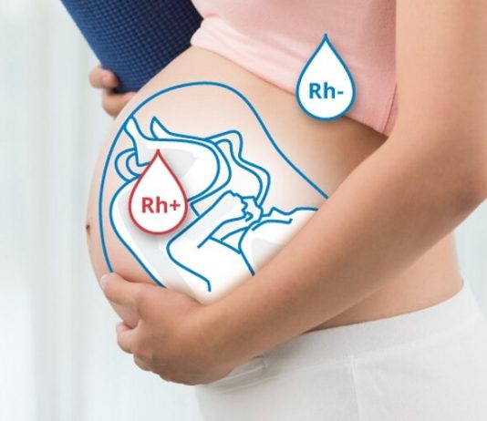 Резус-конфликт при беременности