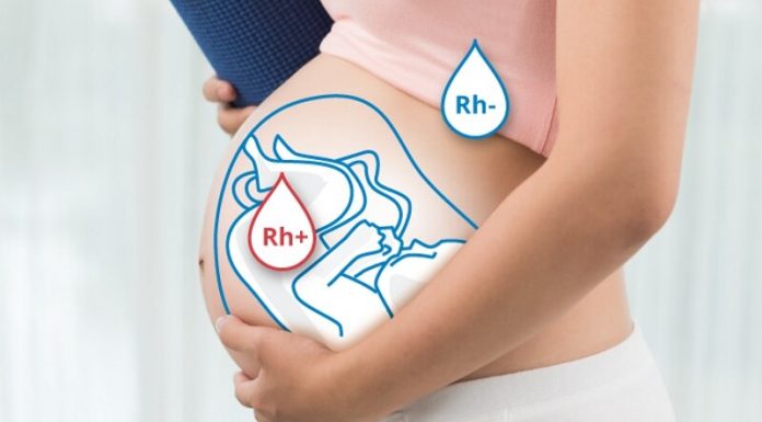 Резус-конфликт при беременности
