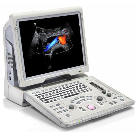 Достоинства УЗИ аппарата Mindray