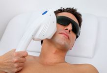 Лазерная эпиляция для мужчин: особенности процеду