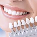 Этапы протезирования зубов