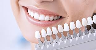 Этапы протезирования зубов