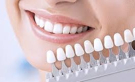 Показания к протезированию зубов