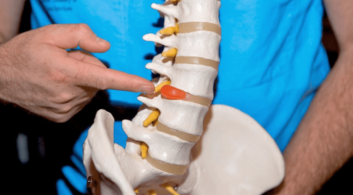 Межпозвоночная грыжа: методы лечения