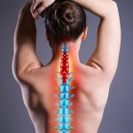 Как лечить грыжу шейного отдела позвоночника?