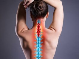 Как лечить грыжу шейного отдела позвоночника?