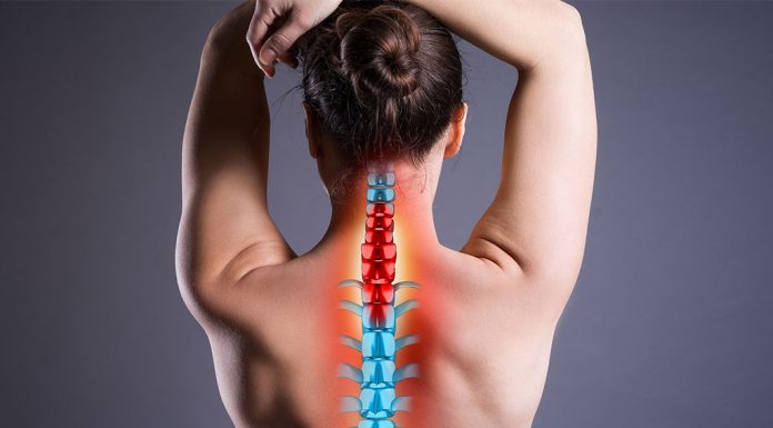 Как лечить грыжу шейного отдела позвоночника?