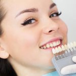 Отбеливание зубов: мифы и реальность
