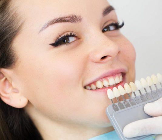 Отбеливание зубов: мифы и реальность