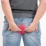 Как лечить геморрой и чем он опасен?