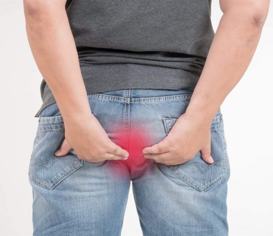 Как лечить геморрой и чем он опасен?