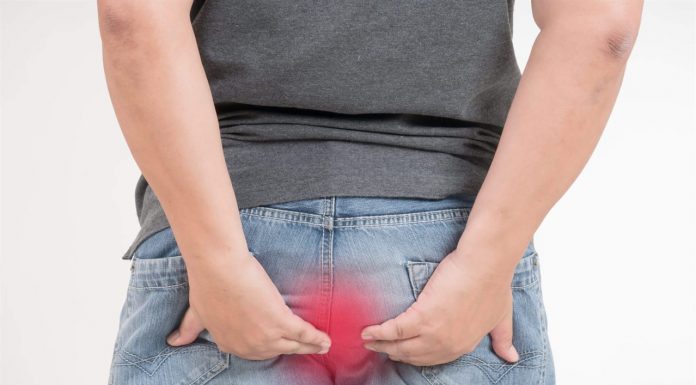 Как лечить геморрой и чем он опасен?