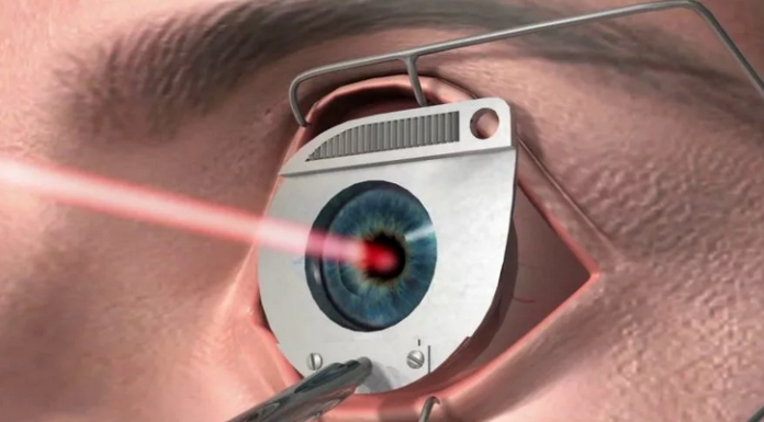 Лазерная коррекция зрения: показания и методы лечения