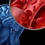 Средства для улучшения мозгового кровообращения