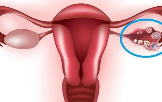 Опасна ли функциональная киста яичника?