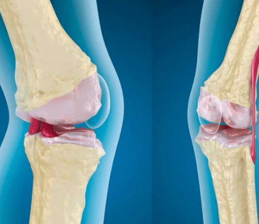 Заболевания суставов, диагностика и методы лечения