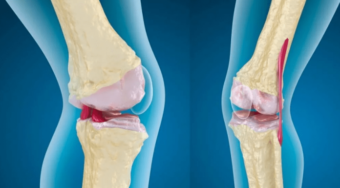 Заболевания суставов, диагностика и методы лечения