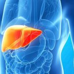 Алкогольный цирроз печени