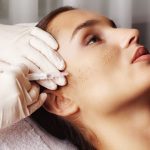 Омоложение на основе мезококтейлей: как улучшается состояние кожи