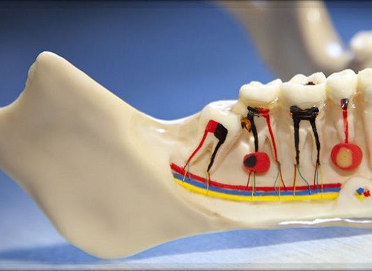 Что такое гемисекция зуба и кому она показана