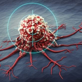 Что такое липома и от неё избавиться?