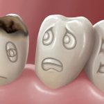 Нужно ли лечить даже очень маленький кариес?