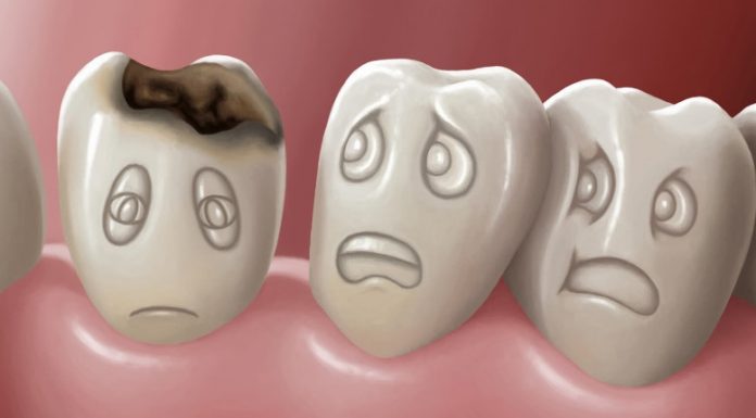 Нужно ли лечить даже очень маленький кариес?