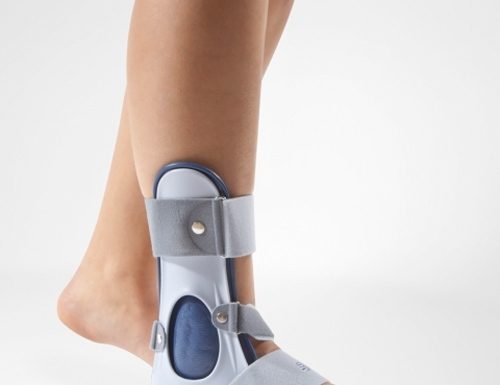 Для чего нужен ортез на голеностопный сустав?