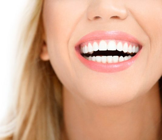 Современные методики отбеливания зубов