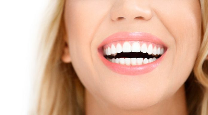 Современные методики отбеливания зубов