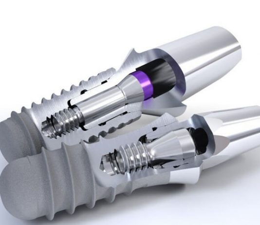 Импланты Штрауман: качество и надежность