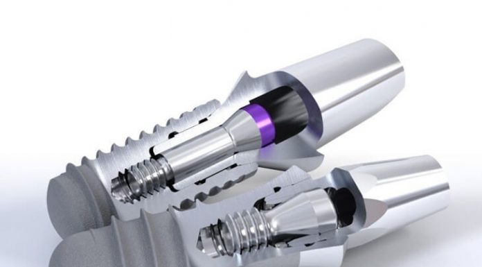 Импланты Штрауман: качество и надежность