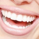 Современные методы отбеливания зубов: плюсы и минусы