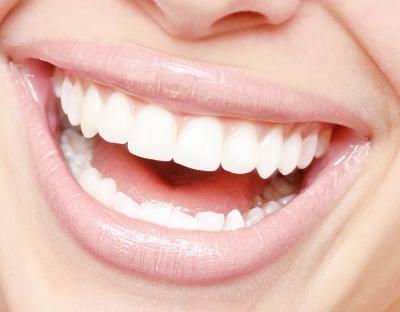 Современные методы отбеливания зубов: плюсы и минусы